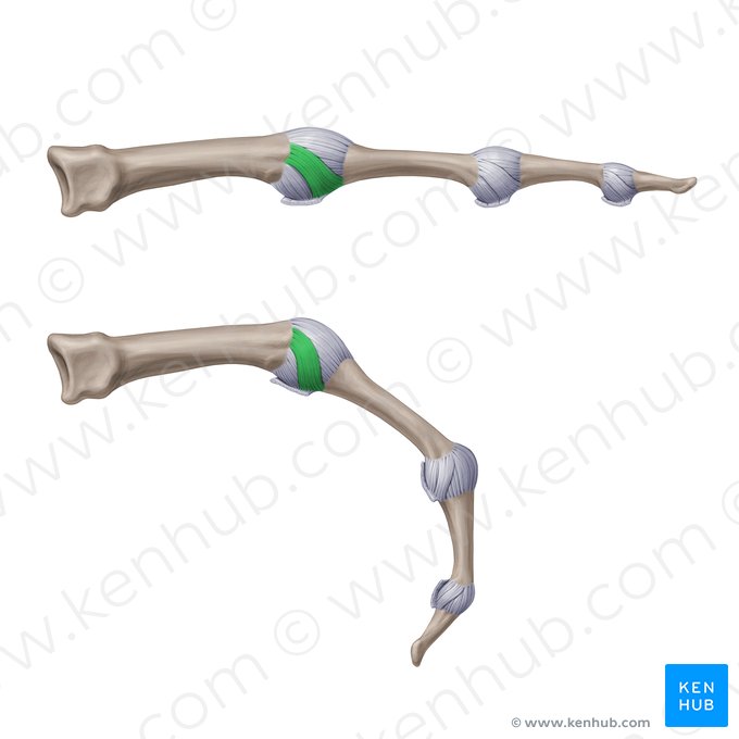 Ligamentos metacarpofalângicos colaterais verdadeiros (Ligamenta metacarpophalangea collateralia propria); Imagem: Paul Kim