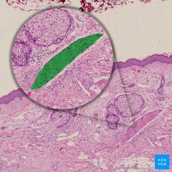 Músculo erector del pelo (Musculus arrector pili); Imagen: 