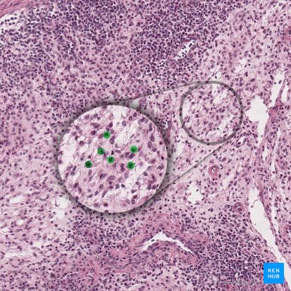 Reticular cells (Cellula reticularis); Image: 