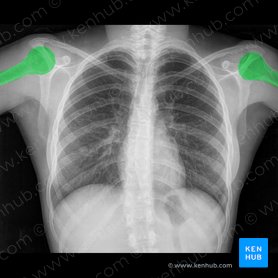 Radiological Anatomy X Ray Ct Mri Kenhub