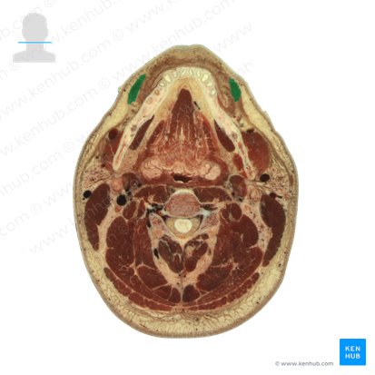 Depressor anguli oris muscle (Musculus depressor anguli oris); Image: National Library of Medicine