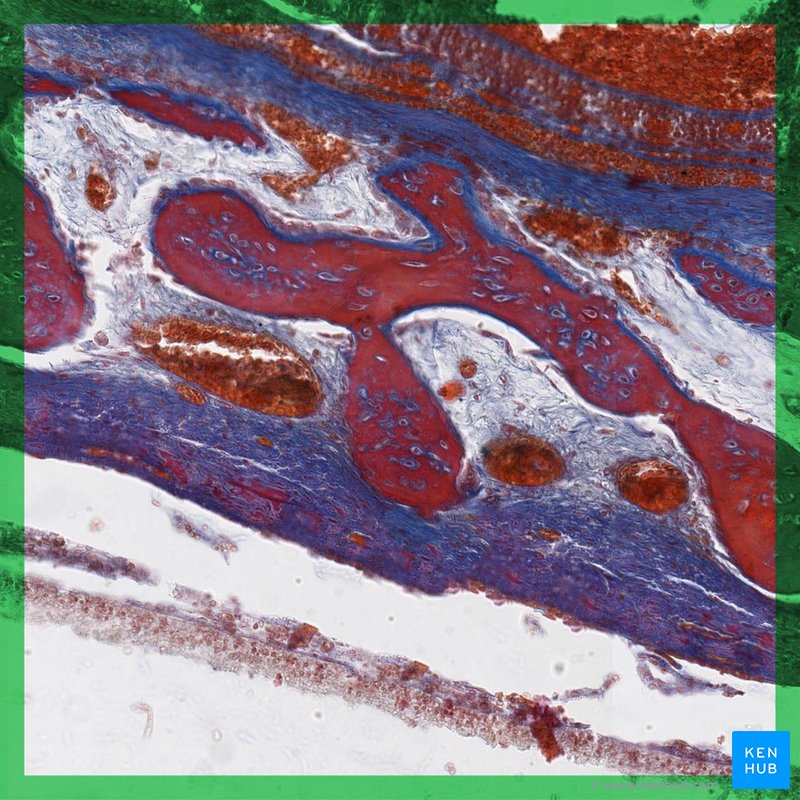 Intramembranous ossification - histological slide