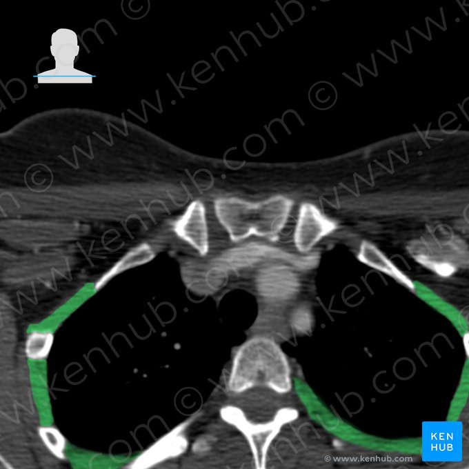 Musculi intercostales (Zwischenrippenmuskeln); Bild: 