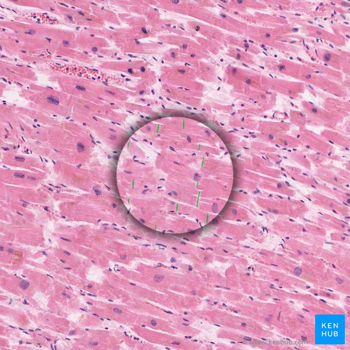 Intercalated discs (Disci intercalati); Image: 