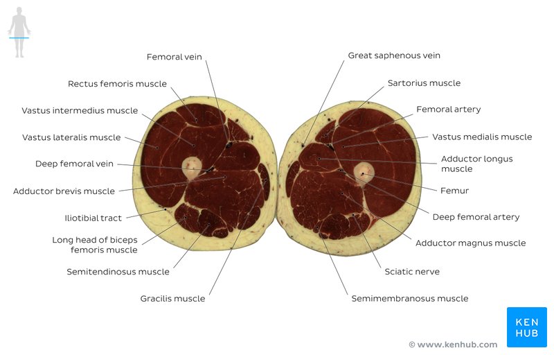 Cross sectional anatomy Kenhub