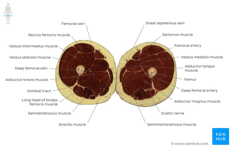 Thigh cross section through the adductor longus muscle: Axial view