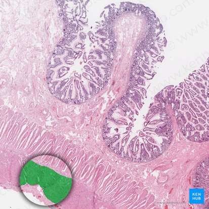 Capa longitudinal externa de la túnica muscular (Stratum longitudinale externum tunicae muscularis); Imagen: 