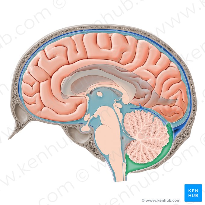 Cisterna cerebelobulbar posterior (Cisterna cerebellomedullaris posterior); Imagen: Paul Kim