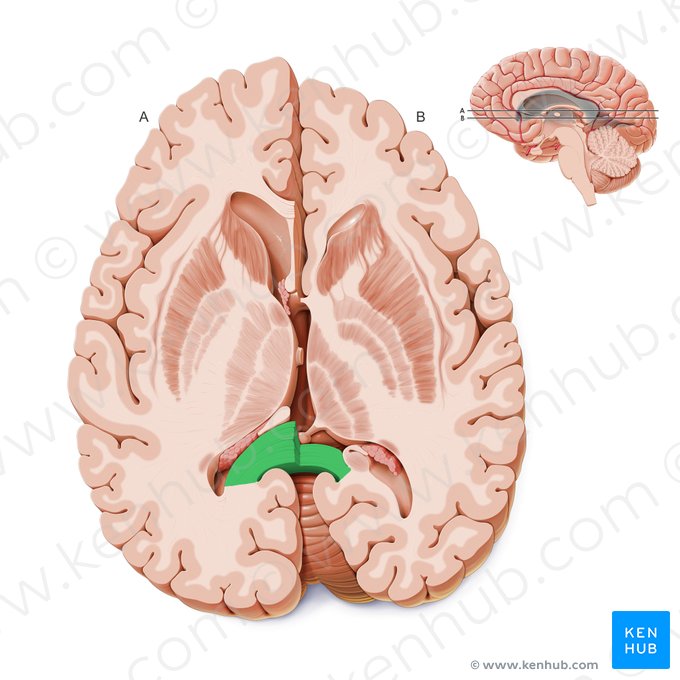 Esplênio do corpo caloso (Splenium corporis callosi); Imagem: Paul Kim