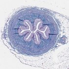 Harnleiter (Ureter)