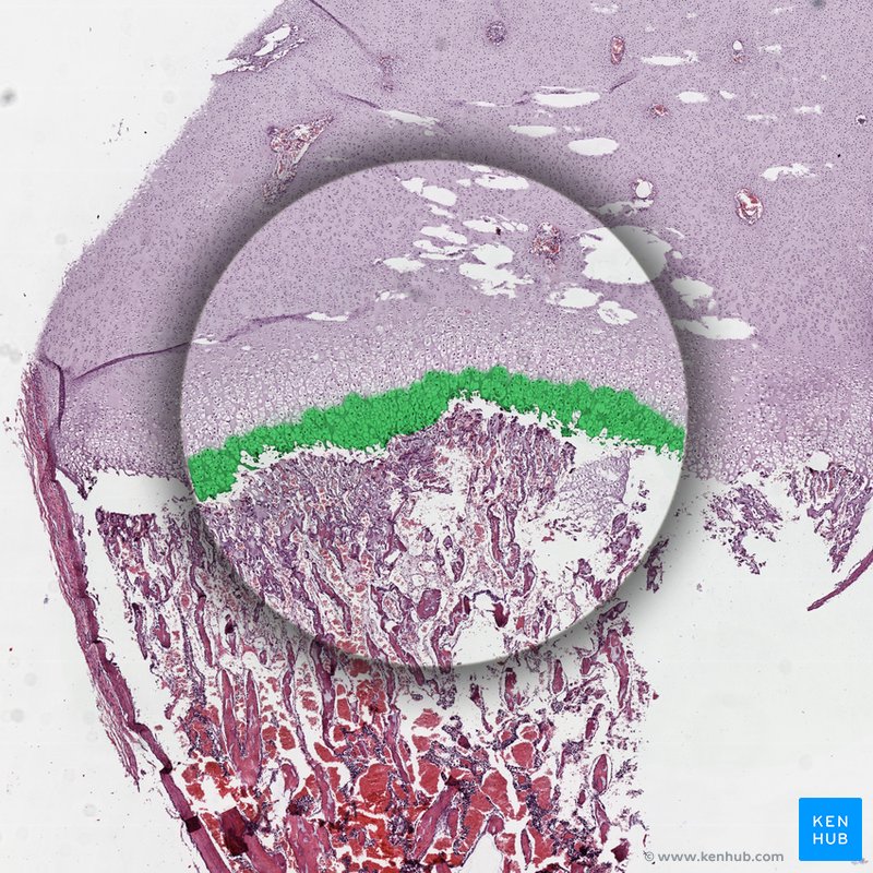 Zone of maturation and hypertrophy - histological slide