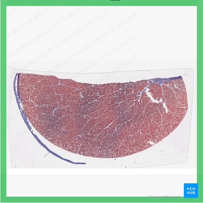 Testis (Hoden); Bild: 