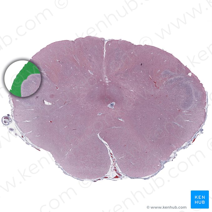 Tracto espinal del nervio trigémino (Tractus spinalis nervi trigemini); Imagen: 