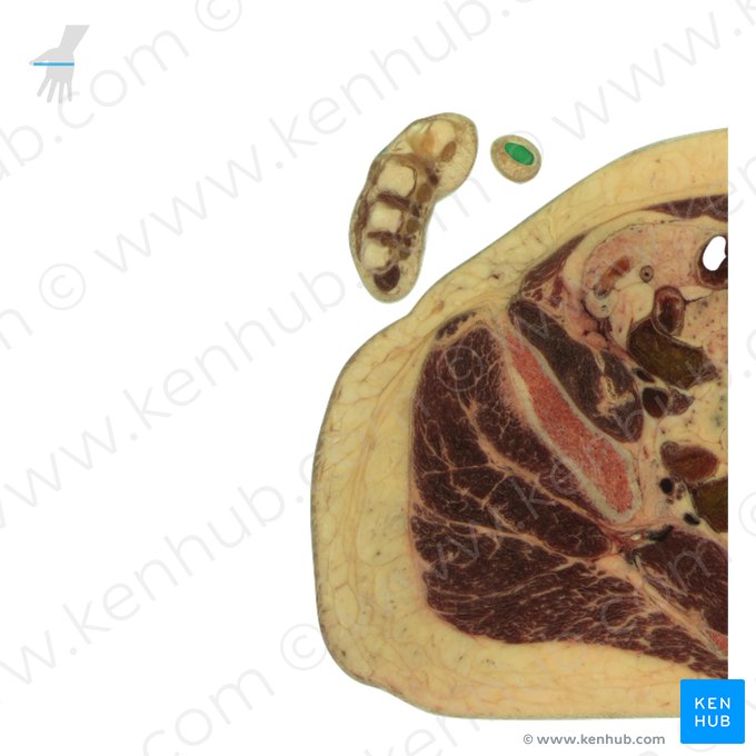 Falange distal do polegar (Phalanx distalis pollicis); Imagem: National Library of Medicine