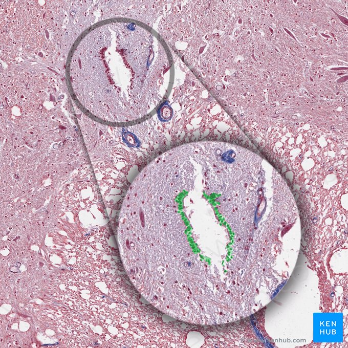 Ependymal cells (Ependymocyti); Image: 