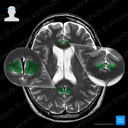 Gyrus cingulaire (Gyrus cinguli); Image : 