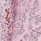 Fibrocartilage