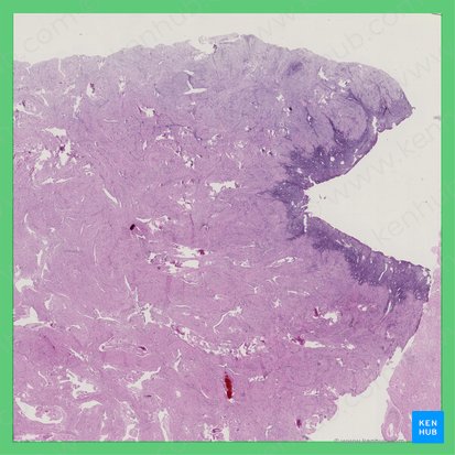 Phasis proliferativa incipiens (Uterus) (Frühe Proliferationsphase des Uterus); Bild: 