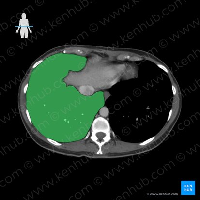 Right lung (Pulmo dexter); Image: 