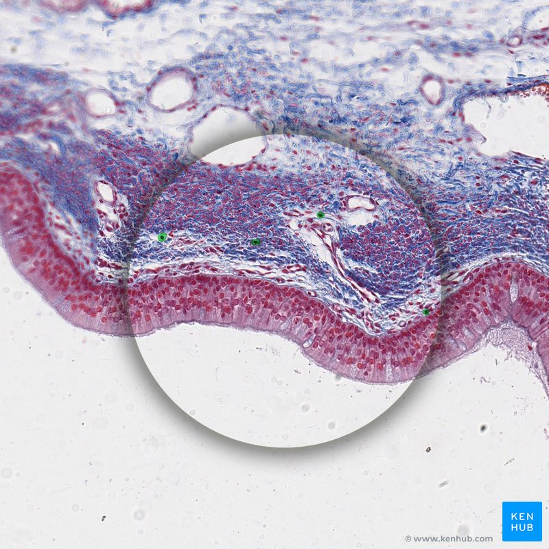Lymphocytes - histological slide