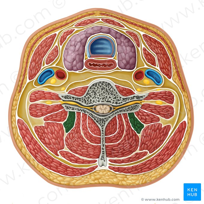 Splenius cervicis muscle (Musculus splenius cervicis); Image: Irina Münstermann