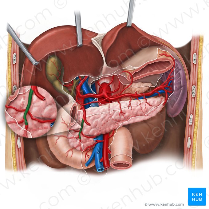 Arteria pancreaticoduodenalis superior anterior (Vordere obere Bauchspeicheldrüsen-Zwölffingerdarm-Arterie); Bild: Esther Gollan