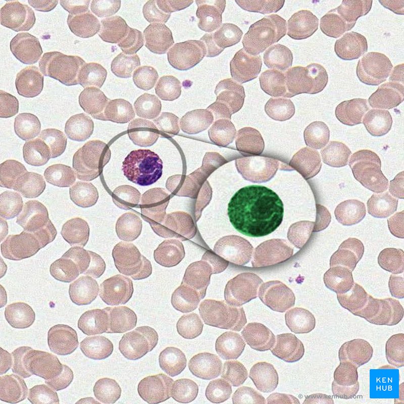 Wright Giemsa stain (Eosniphil) - histological slide 