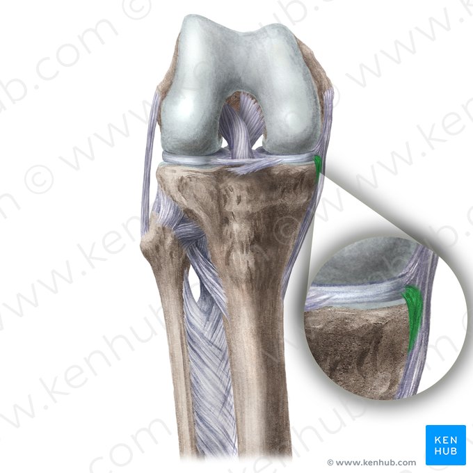 Ligamento meniscotibial lateral (Ligamentum meniscotibiale mediale); Imagen: Liene Znotina