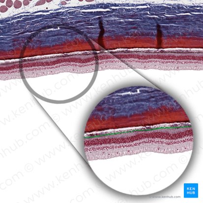 Epithelium simplex cuboideum pigmentosum (Pigmentepithelschicht); Bild: 