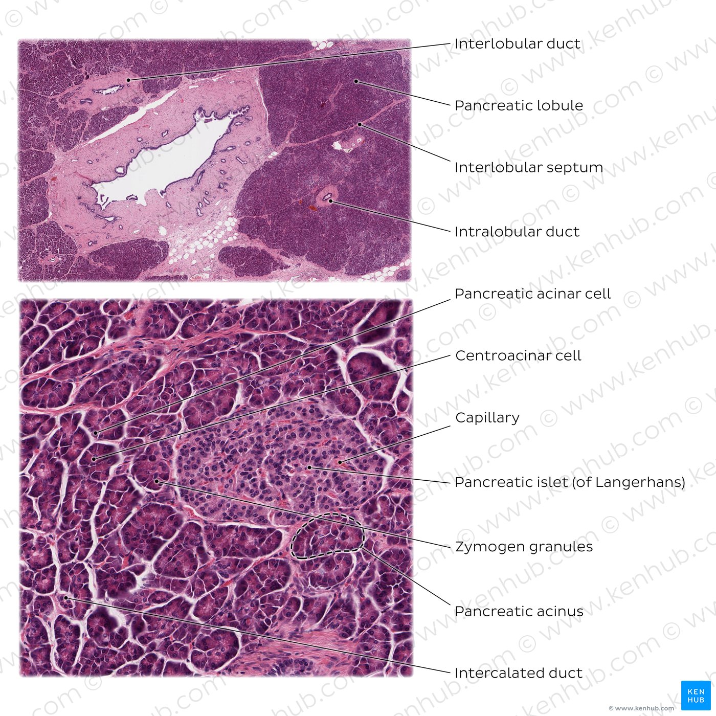 Pancreas. Stain: H&E. Top: Medium magnification. Bottom: High magnification