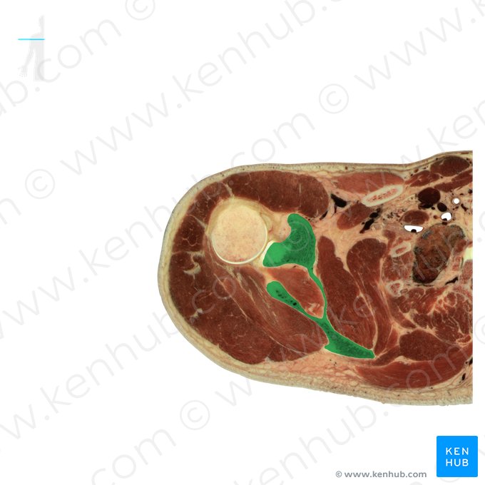 Escápula (Scapula); Imagem: National Library of Medicine