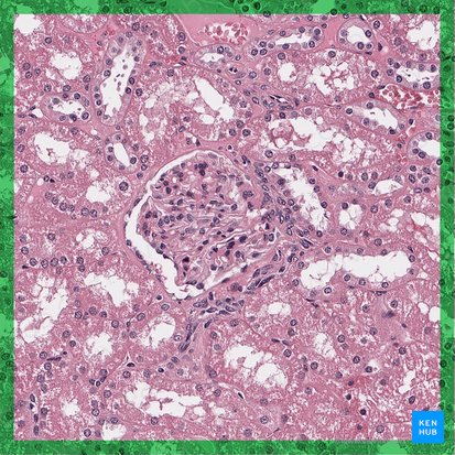 Renal corpuscle (Corpusculum renale); Image: 