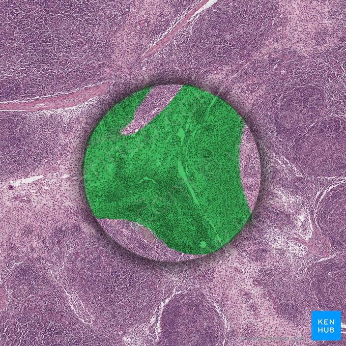 Reticular connective tissue; Image: 