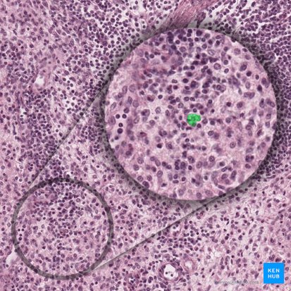 Macrophagocytus (Makrophage); Bild: 