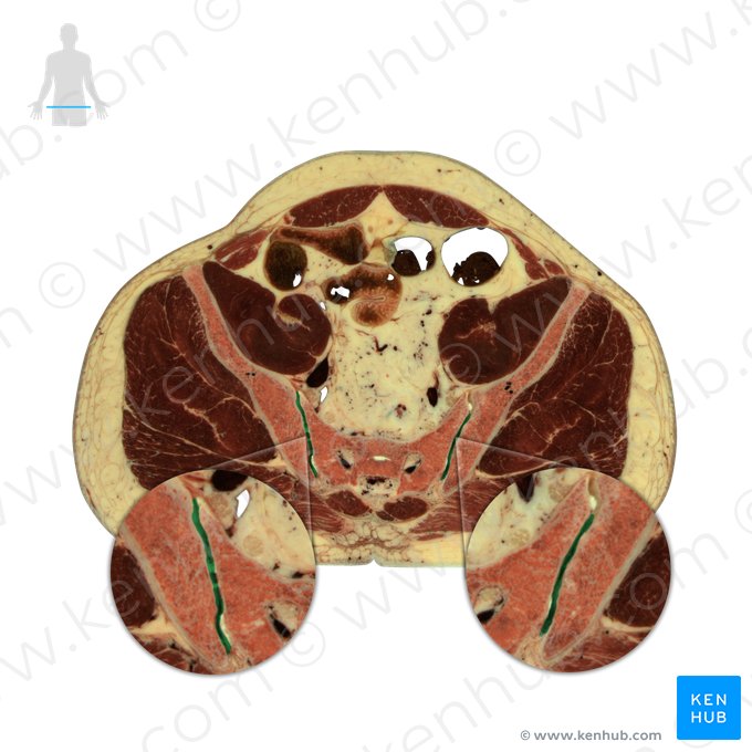 Sacroiliac joint (Articulatio sacroiliaca); Image: National Library of Medicine