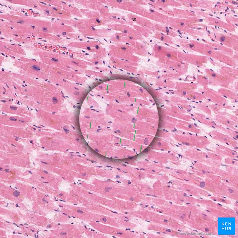 Intercalated discs - histological slide