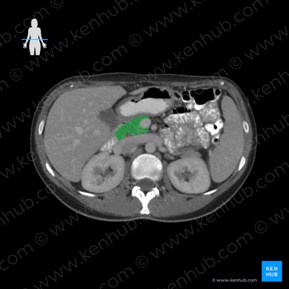 Pancreas (Bauchspeicheldrüse); Bild: 