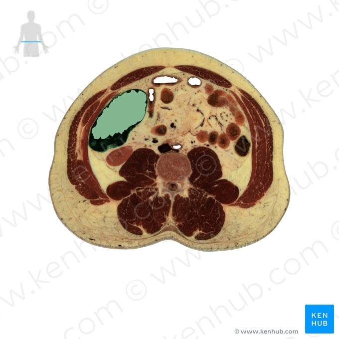 Ascending colon (Colon ascendens); Image: National Library of Medicine