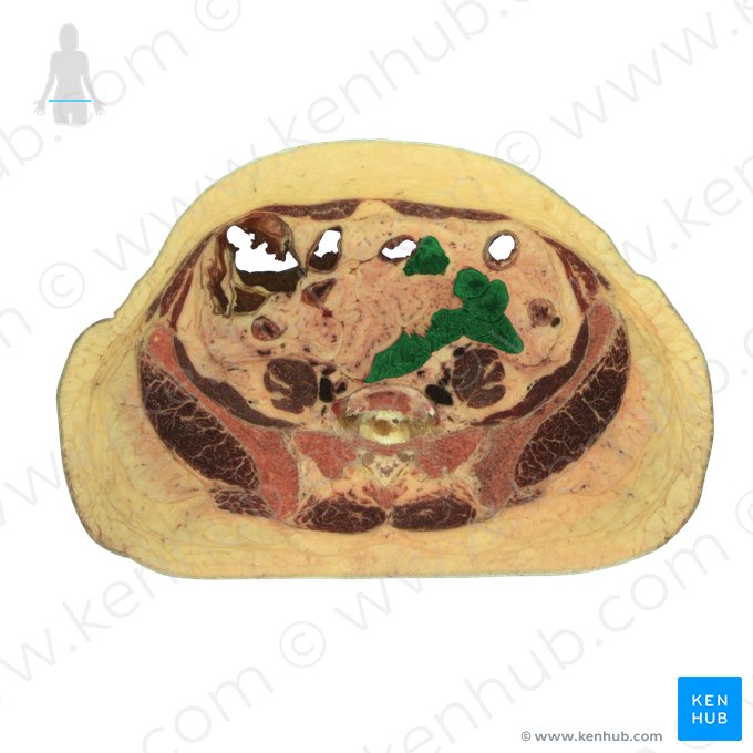 Ileum (Krummdarm); Bild: National Library of Medicine