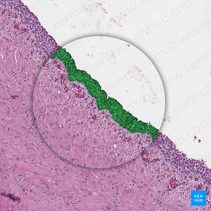 Urotelio (Urothelium); Imagen: 