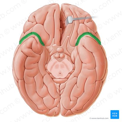 Sulco lateral (Sulcus lateralis); Imagem: Paul Kim