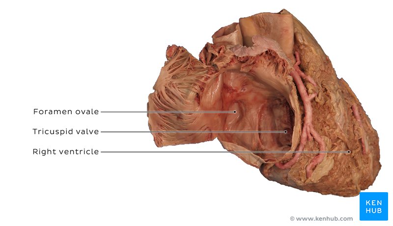Dissected right atrium in a cadaver