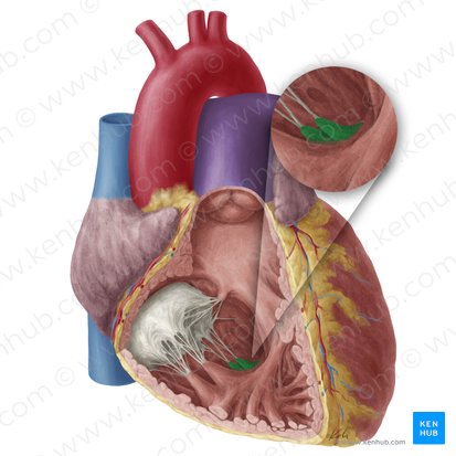 Musculus papillaris inferior ventriculi dextri (Hinterer Papillarmuskel der rechten Herzkammer); Bild: Yousun Koh