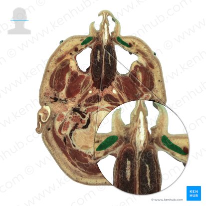 Musculus levator labii superioris (Oberlippenheber); Bild: National Library of Medicine