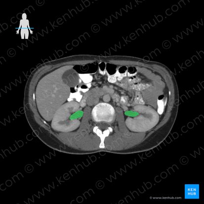 Pelve renal (Pelvis renalis); Imagem: 