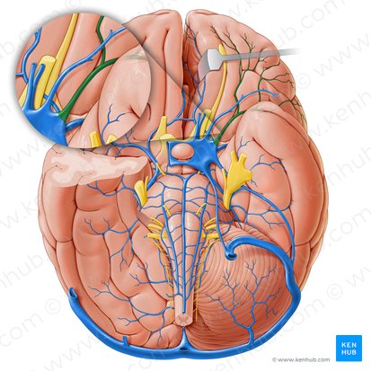 Superficial middle cerebral vein (Vena media superficialis cerebri); Image: Paul Kim