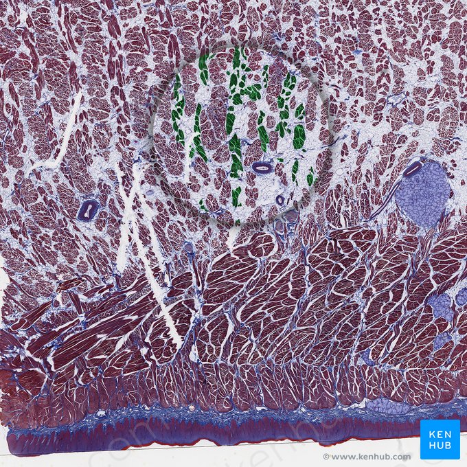 Vertical muscle of tongue (Musculus verticalis linguae); Image: 