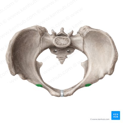 Eminência iliopúbica do osso do quadril (Eminentia iliopubica ossis coxae); Imagem: Liene Znotina