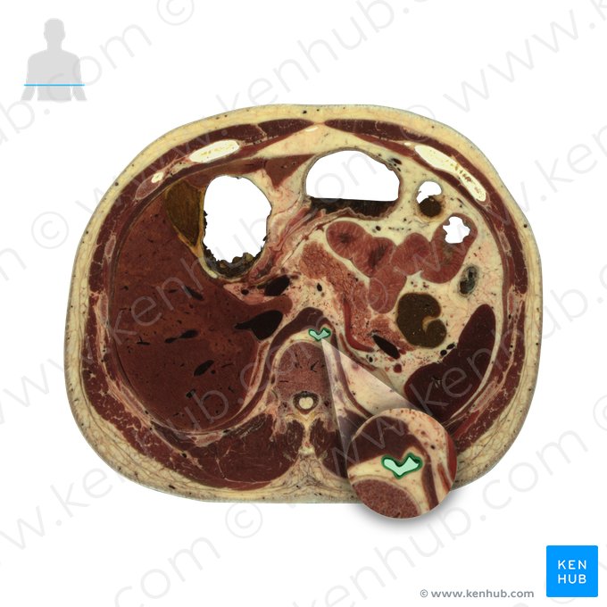 Aorta abdominal (Aorta abdominalis); Imagem: National Library of Medicine