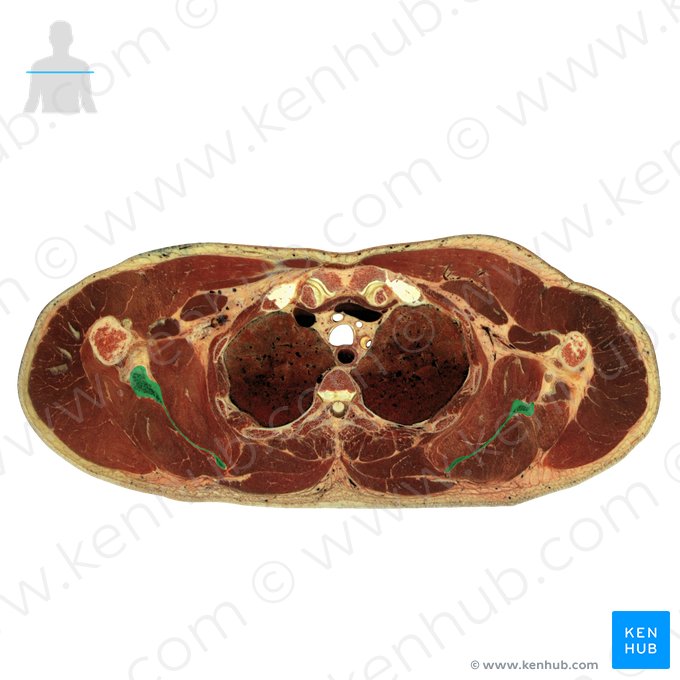 Escápula (Scapula); Imagem: National Library of Medicine